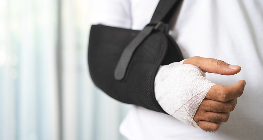 broken arm in cast